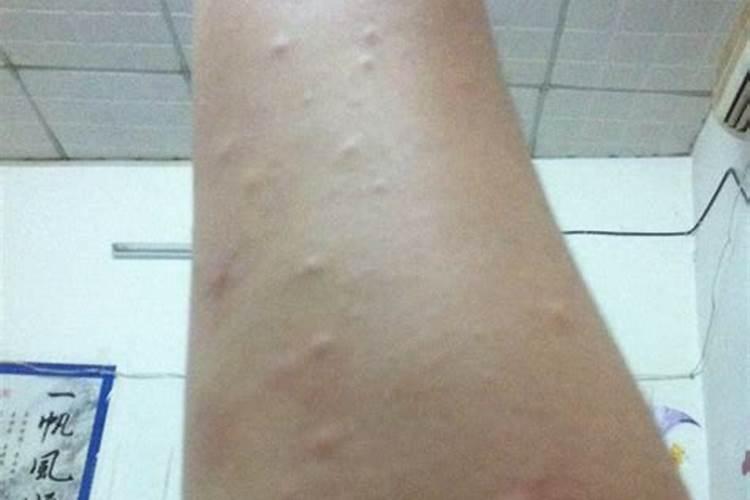 梦到胳膊上长好多硬疙瘩