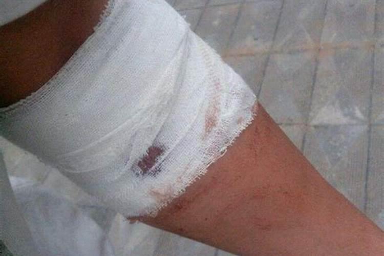 梦见别人割腕流血了