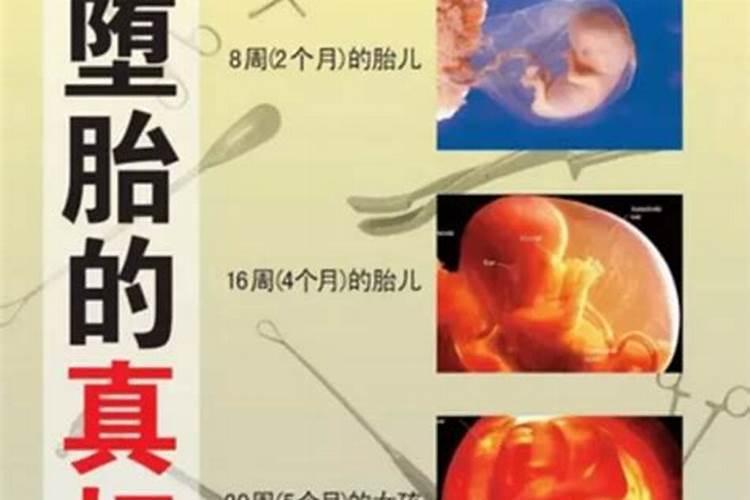 做引产胎宝宝会来报仇吗  百度宝宝知道